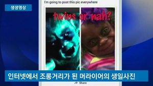 [생생영상] "내 딸은 괴물이 아니에요"&hellip;희귀병 앓는 아이 사진에 못된 낙서