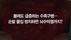 [닥터스] 아이들 많이 걸리는 수족구병, 놔뒀다간 사망까지&hellip;