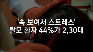 [닥터스] '속 보여서 스트레스'&hellip;탈모 환자 44%가 2&sim;30대