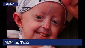 [자막뉴스] 웃음으로 감동주던 '100살 소녀'&hellip;끝내 하늘로 떠나다