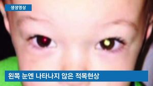 [생생영상] '사진이 이상해' 아들의 암 발견한 엄마
