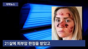 [자막뉴스] 피부 그을리다 피부암&hellip;인공 선탠 주의보