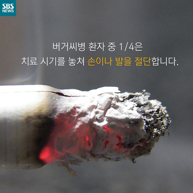 메인이미지  11 : 