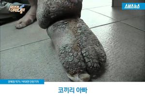 쓰린 다리로 고물 줍는 '코끼리 아빠', 사연은?