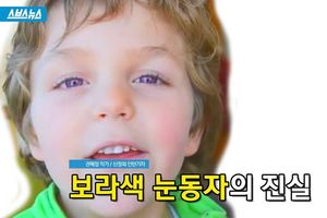 보라색 눈동자 가진 아이 사진 화제&hellip;'희귀병?'