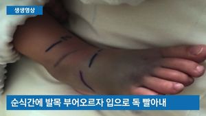 [생생영상] 아이가 뱀에 물리자&hellip;'임신 9개월' 엄마의 뜨거운 모성