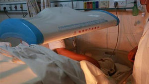 [월드리포트] 암 재발하자 담당의에게 방화 테러…위협받는 中 의료인