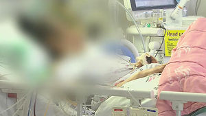 메르스 전파 환자 공통점 "발병 후 확진 늦고 폐렴 증상"