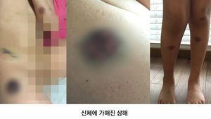 '체포놀이' 빙자해 발달장애 초등생 폭행 논란