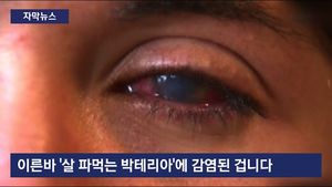 [자막뉴스] 하루 만에 실명&hellip;美 '살 파먹는 박테리아' 비상