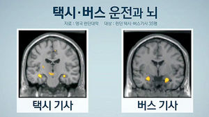 [건강리포트] 어려운 문제 풀어 뇌 활동?&hellip;치매 악화시킨다
