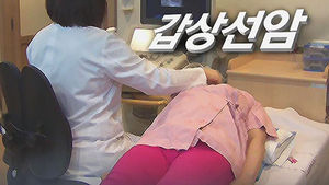 갑상선 초음파 증상 없으면 안 받아도 된다
