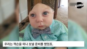 [비디오머그] 美, 두개골 일부 없이 태어난 아기&hellip;그 후