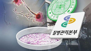"건대 집단폐렴, '실험실 사료'서 병원체 증식 추정"