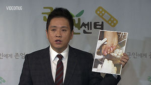 [비디오머그] 발가락에 불 붙인 '나쁜 동기'&hellip;군 잔혹사 '끔찍'