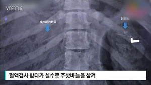 [비디오머그] 실수로 그만&hellip;주사바늘 삼킨 판다 '긴박한 상황'