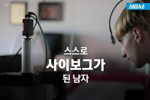 머리에 안테나를 심은 남자&hellip;사이보그가 된 사연