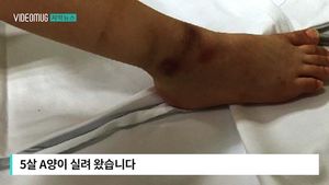 [자막뉴스] '5살 딸에 뜨거운 물 부은 엄마' 친권 상실