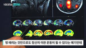 [자막뉴스] '멍 때린' 후 기억력 측정해보니&hellip;반전 결과