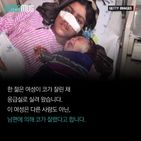 섬네일이미지  2: