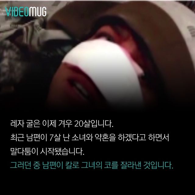 메인이미지  3 : 