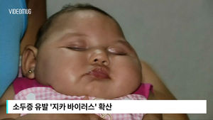 [비디오머그] '소두증 바이러스' 갈수록 확산&hellip;임신부 공포