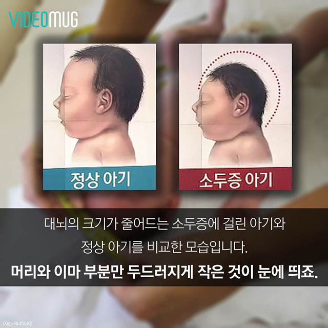 메인이미지  3 : 