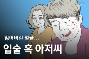 '식당 가는 것이 꿈'&hellip;입술 혹 아저씨의 슬픈 사연