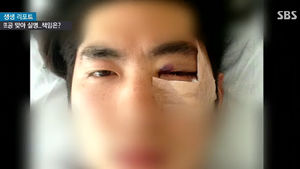 [취재파일] "1억 원을 준다면 한 쪽 눈으로만 사시겠어요?"
