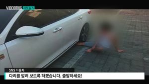 [자막뉴스] 결국 돈 때문에&hellip;'좋아요' 얻으려 충격적 자해