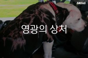 세상에서 가장 자랑스러운 '상처'