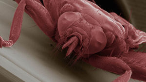 [취재파일] 기후변화&hellip;기생충 다시 불러오나