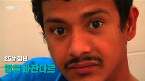 [비디오머그] '나무'처럼 변해버린 손&hellip;첫 수술 후 되찾은 미소