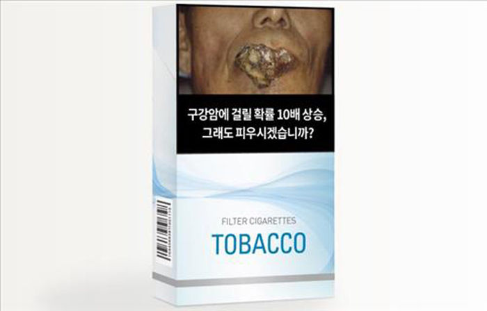 메인이미지  3 : 구강암 환자의 사진