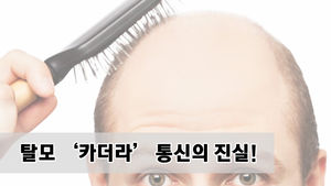 소금물로 머리 감아라?&hellip;탈모 '카더라 통신'의 진실