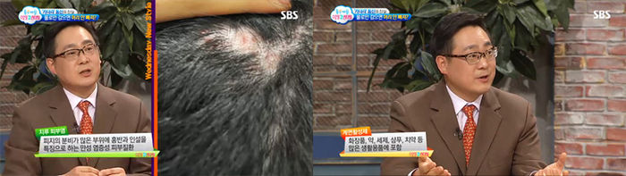 샴푸의 화학성분이 좋지 않다는 이유 때문에 한동안 노 샴푸, 일명 '노푸(NO POO)'가 유행했었죠. 샴푸 속 화학성분이 탈모를 악화시킬까봐 걱정하시는 분들이 많이 계신데, '노푸'가 탈모 방지에 도움이 될까요?