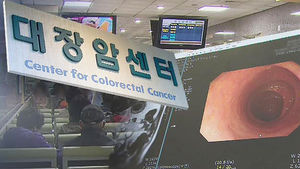 대장암 발생위치 '서구화'&hellip;"조기 발견 중요해"