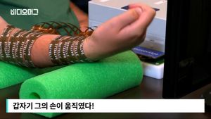 [비디오머그] 5년 동안 움직이지 못했는데&hellip;'뇌 센서'로 새 희망