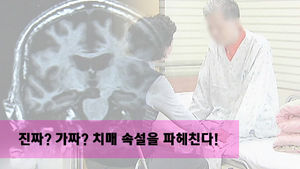 '머리 작을수록 치매 잘 걸린다?'&hellip;속설 파헤치기