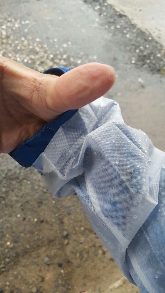 폭우 취재 도중 살펴본 손가락