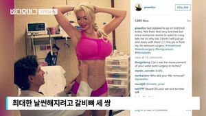 [자막뉴스] 갈비뼈 제거해서 날씬?&hellip;'성형 모델' 논란