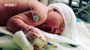 [비디오머그] '기적의 탄생'&hellip;미국서 두개골 없이 태어난 아이 화제