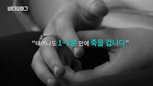 두개골이 없는 아이?&hellip;美 기적의 탄생
