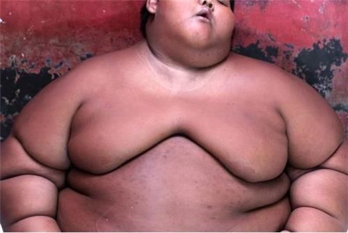 몸무게가 192㎏까지 불어난 인도네시아 10대 소년 아르야 페르마나 (자료= 인민망 화면캡처)