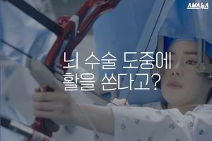 뇌 수술 중에 활을 쏜다고? '진짜'