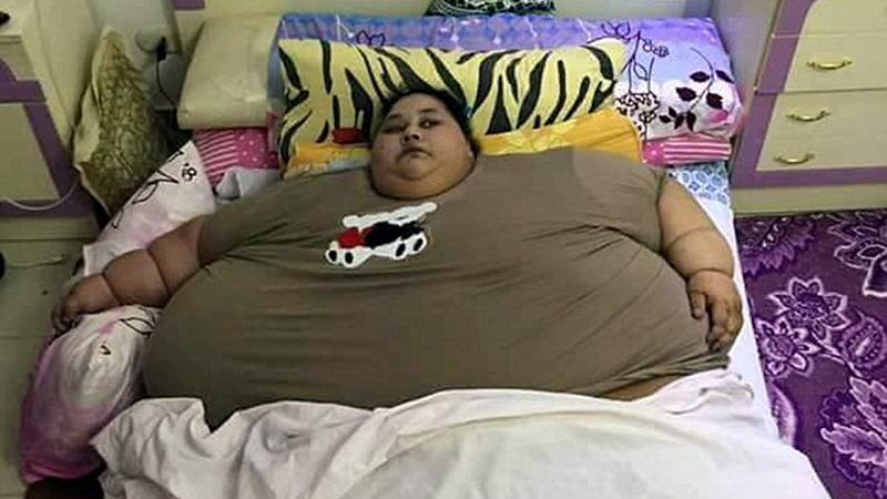 [뉴스pick] 세상에서 가장 뚱뚱한 여성 