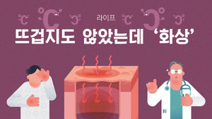 [라이프] 추운 날씨에 끼고 있다가 '화상'…뜨겁지도 않았는데?!