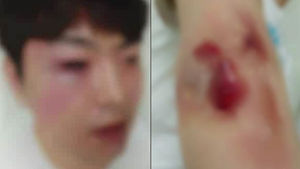 [오!클릭] '무고한 시민 폭행'…경찰 "재발 방지 노력하겠다"