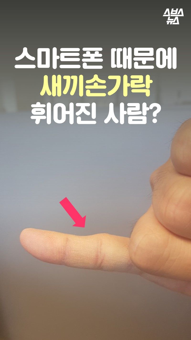 스마트폰 때문에
새끼손가락
휘어진 사람?