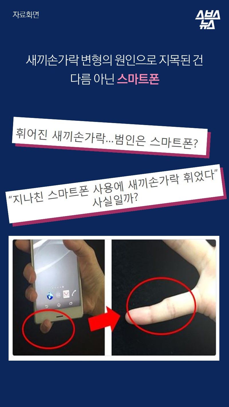 새끼손가락 변형의 원인으로 지목된 건
다름 아닌 스마트폰